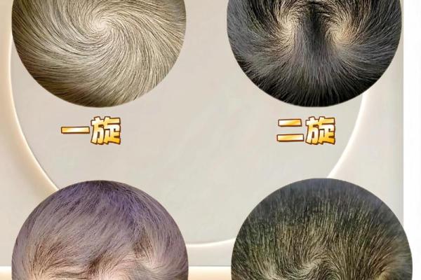 头顶的三个旋，命运的错乱与改变，隐藏的误区你知道吗？